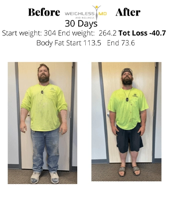 Weight Loss St. Louis MO Before And After