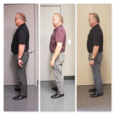 Weight Loss St. Louis MO Before And After