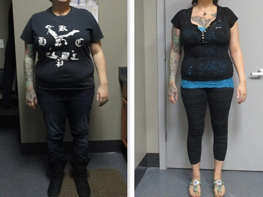 Weight Loss St. Louis MO Before And After