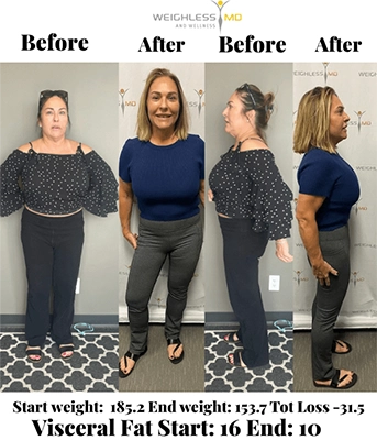 Weight Loss St. Louis MO Before And After