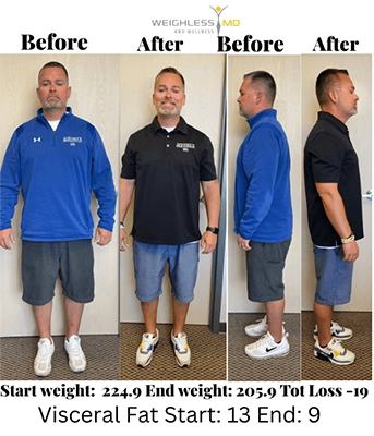 Weight Loss St. Louis MO Before And After