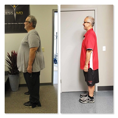 Weight Loss St. Louis MO Before And After