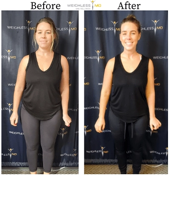 Weight Loss St. Louis MO Before And After