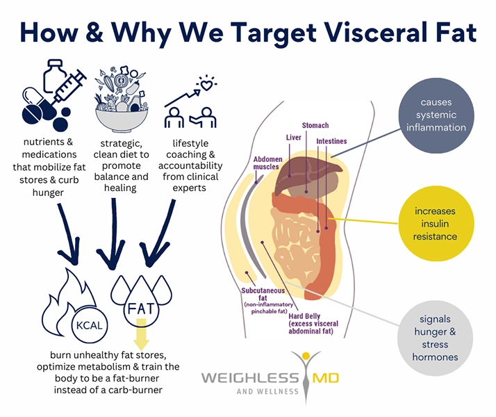 Weight Loss St. Louis MO Visceral Fat Diagram